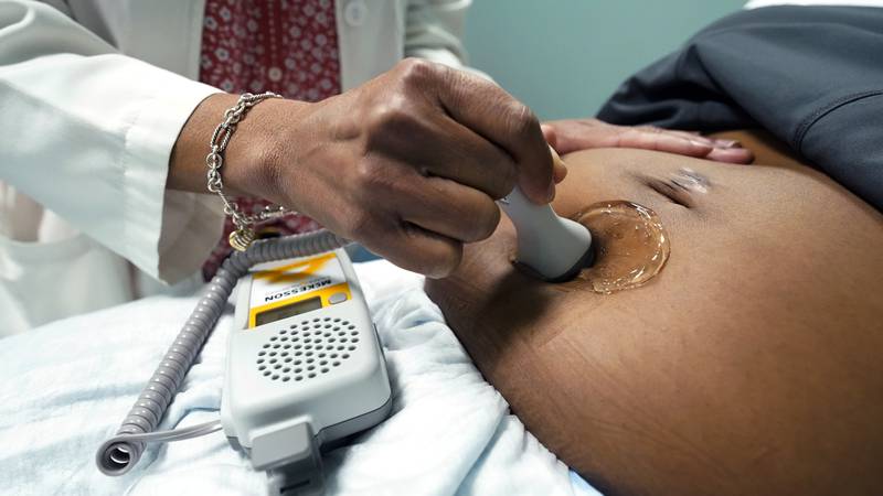 A doctor uses a hand-held Doppler probe on a pregnant woman to measure the heartbeat of the...